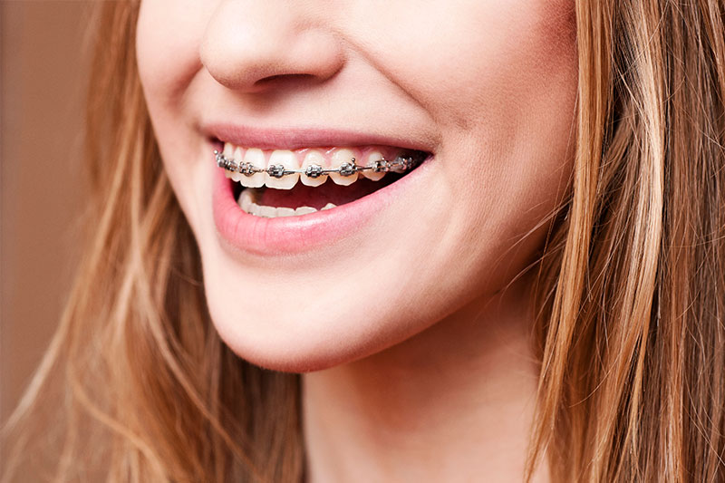 Orthodontics in Fremont